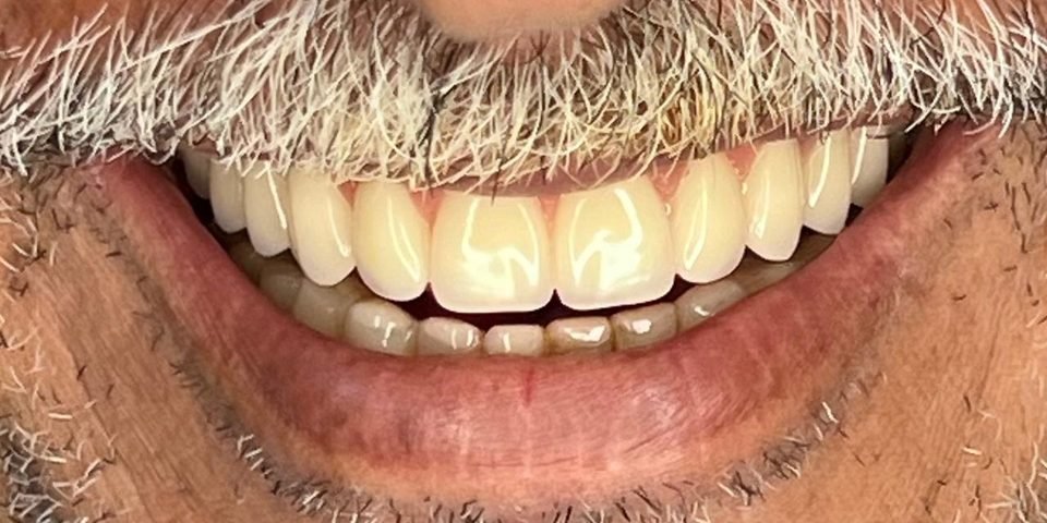 Depois do tratamento – caso 2